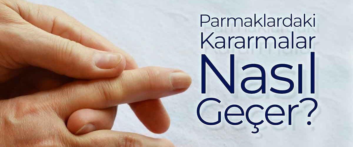 Parmaklardaki-Kararmalar-Nasil-Gecer