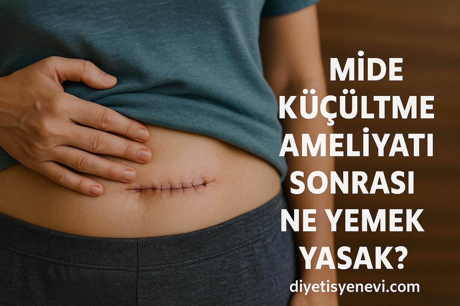 Mide Küçültme Ameliyatı Sonrası Ne Yemek Yasak?