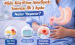 Mide Küçültme Ameliyatı Sonrası İlk 3 Ayda Neler Yaşanır?