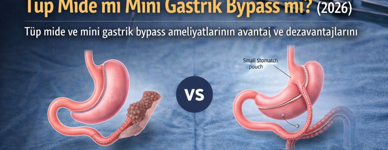 Mide Ameliyatı Çeşitleri: Tüp Mide mi Mini Gastrik Bypass mı? (2026)
